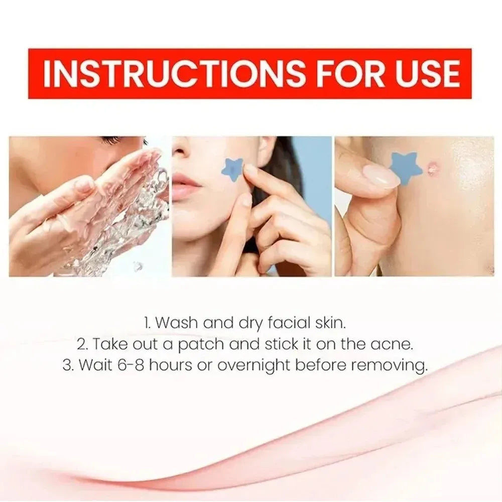 Adesivos Hidrocolóides para Acne – Tratamento Invisível de Espinhas e Manchas, 200 Peças