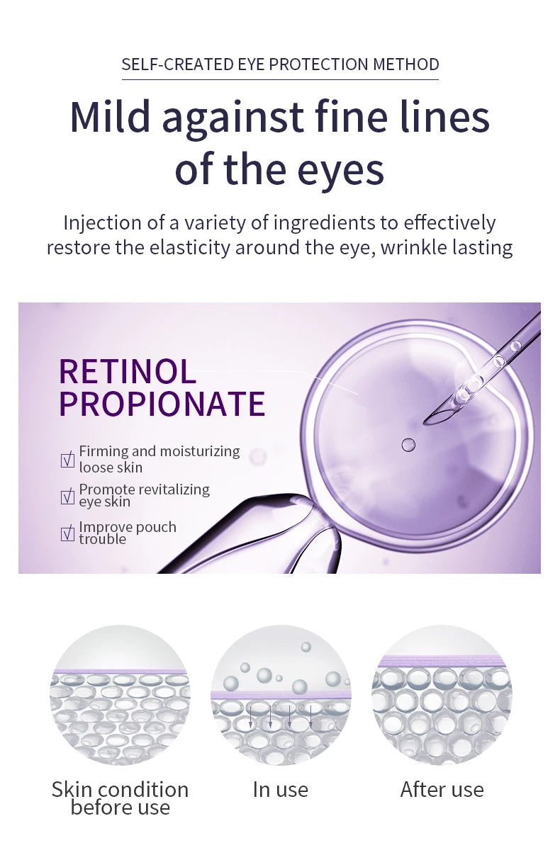 O'CHEAL Creme para Olhos com Massageador – Anti-Rugas, Anti-Olheiras e Anti-Bolsas, Hidratante com Ácido Hialurônico