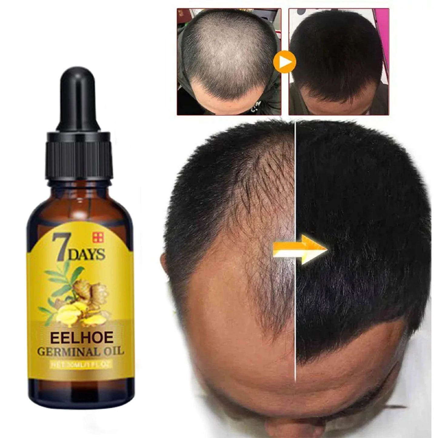 Óleo de Gengibre para Cuidados com o Cabelo – Tratamento Fortalecedor do Couro Cabeludo e Raízes