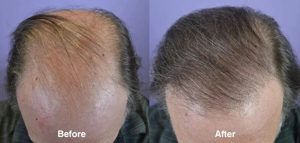 Óleo de Gengibre para Cuidados com o Cabelo – Tratamento Fortalecedor do Couro Cabeludo e Raízes