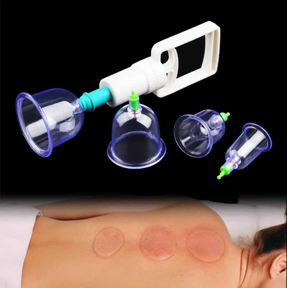 Conjunto de Ventosas a Vácuo com Pistola de Bombeamento – Massagem, Desintoxicação e Cuidados Anticelulite