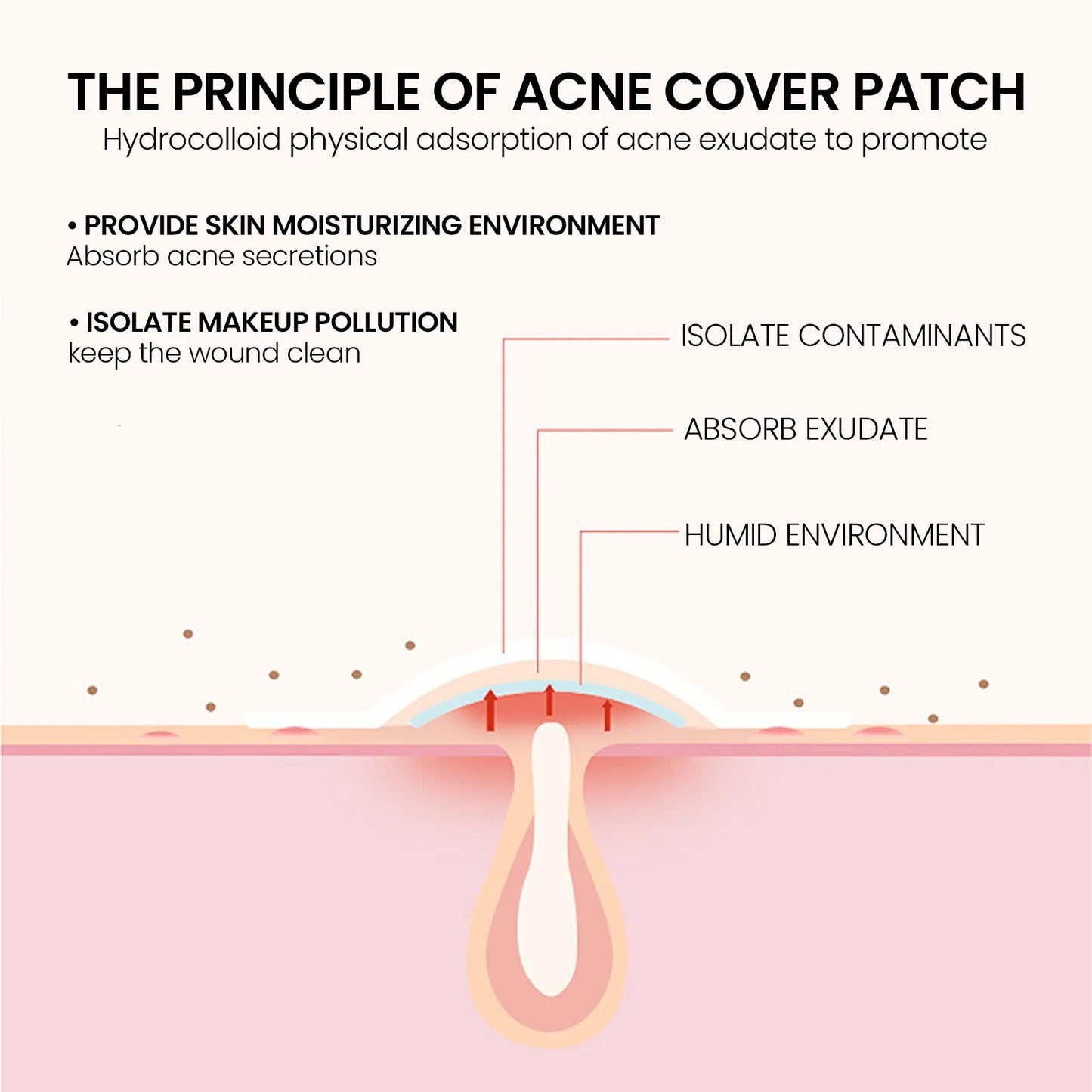 Adesivos Hidrocolóides para Acne – Tratamento Invisível de Espinhas e Manchas, 200 Peças