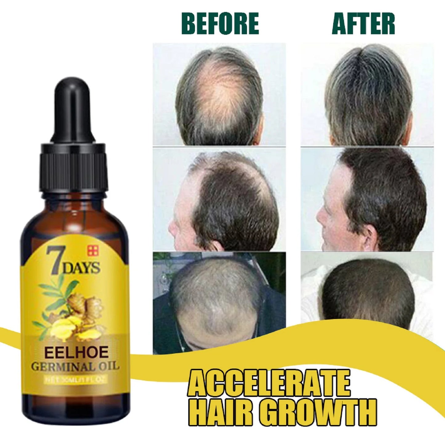 Óleo de Gengibre para Cuidados com o Cabelo – Tratamento Fortalecedor do Couro Cabeludo e Raízes
