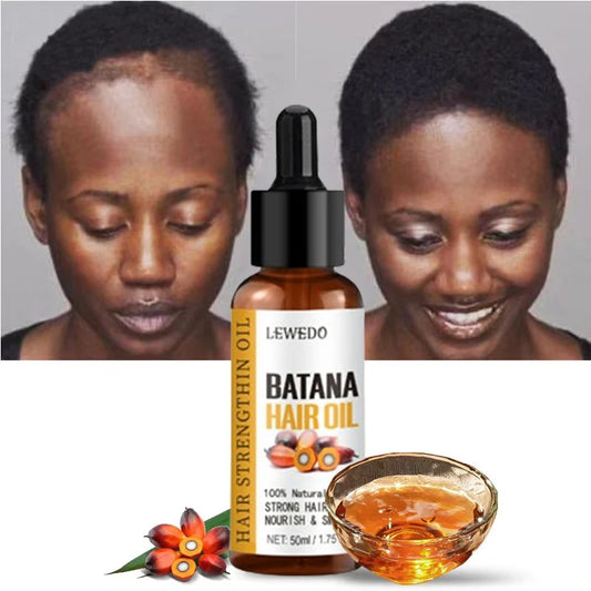 Lewedo Naturals Óleo de Batana Puro – Crescimento Rápido e Cuidado Saudável para Cabelos Masculinos e Femininos