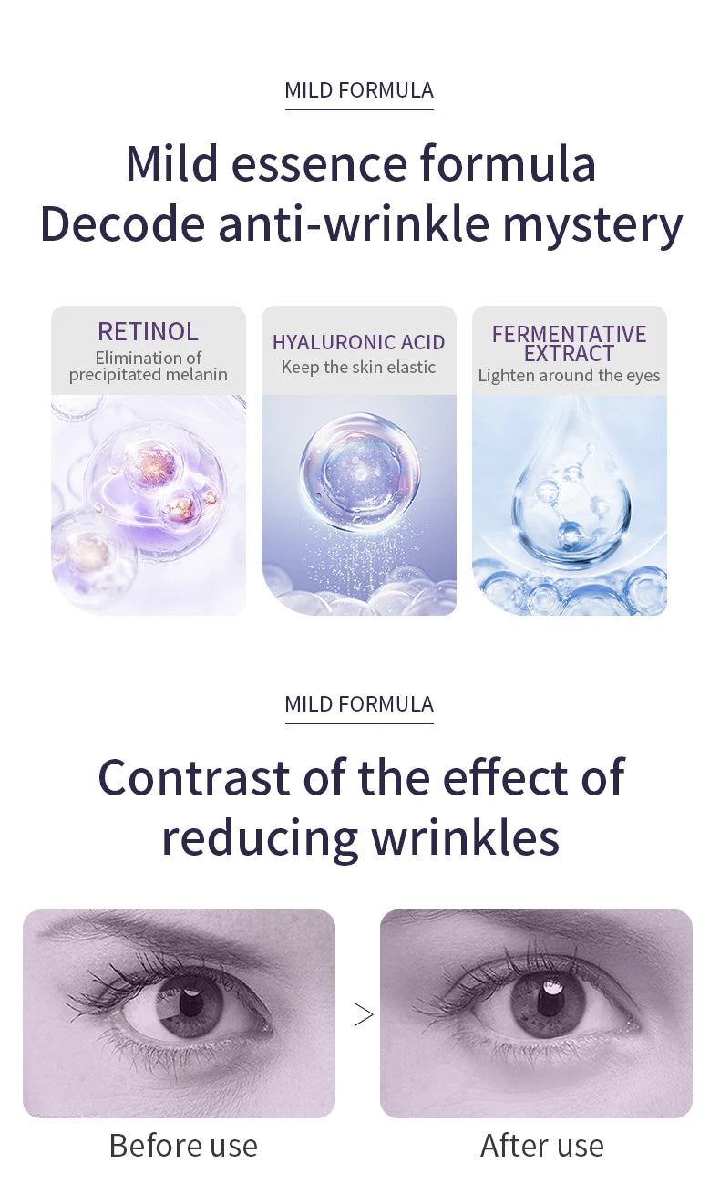 O'CHEAL Creme para Olhos com Massageador – Anti-Rugas, Anti-Olheiras e Anti-Bolsas, Hidratante com Ácido Hialurônico