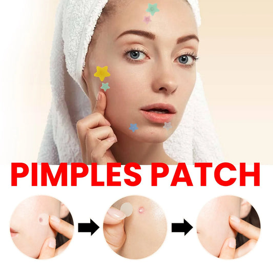 Adesivos Hidrocolóides para Acne – Tratamento Invisível de Espinhas e Manchas, 200 Peças